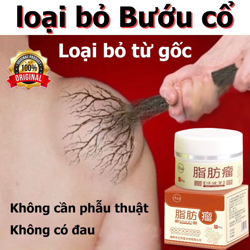 Kem bôi u bướu mỡ 30g loại bỏ Bướu cổ tuyến giáp sưng to Loại bỏ u mỡ hiệu quả Loại bỏ u mỡ không đau Từ chối tái phát