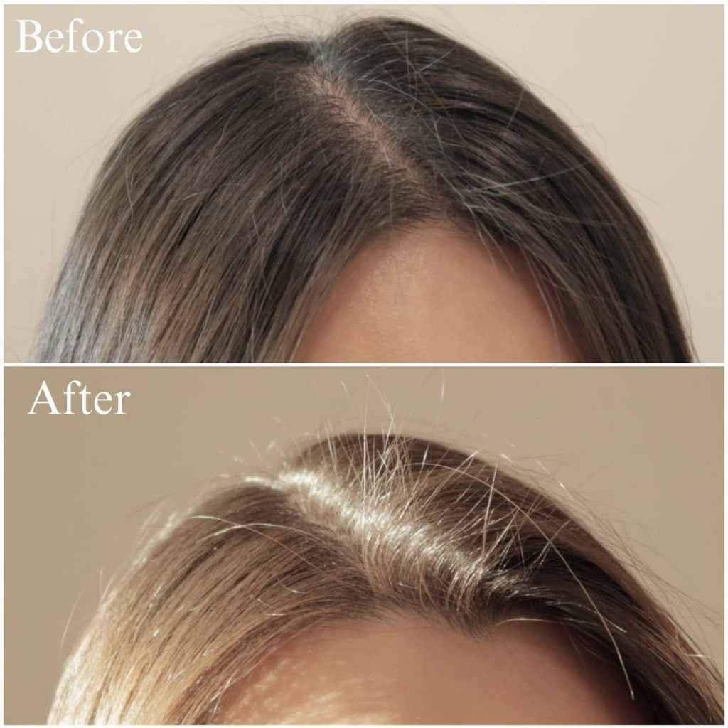 Bộ gội xả Dr.Forhair Folligen