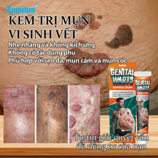 20G Thuốc trị mụn cóc sinh dục Loại bỏ mụn cóc Thuốc tẩy nốt ruồi Tẩy mụn ruồi