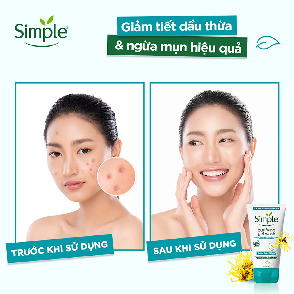 Sữa Rửa Mặt Simple Purifying Gel Wash Kiềm Dầu Ngừa Mụn 150ml