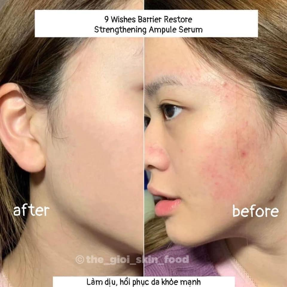 Tinh chất cân bằng phục hồi da 𝟵 𝗪𝗶𝘀𝗵𝗲𝘀 𝗕𝗮𝗿𝗿𝗶𝗲𝗿 𝗥𝗲𝘀𝘁𝗼𝗿𝗲 𝗦𝘁𝗿𝗲𝗻𝗴𝘁𝗵𝗲𝗻𝗶𝗻𝗴 𝗔𝗺𝗽𝘂𝗹𝗲 𝗦𝗲𝗿𝘂𝗺