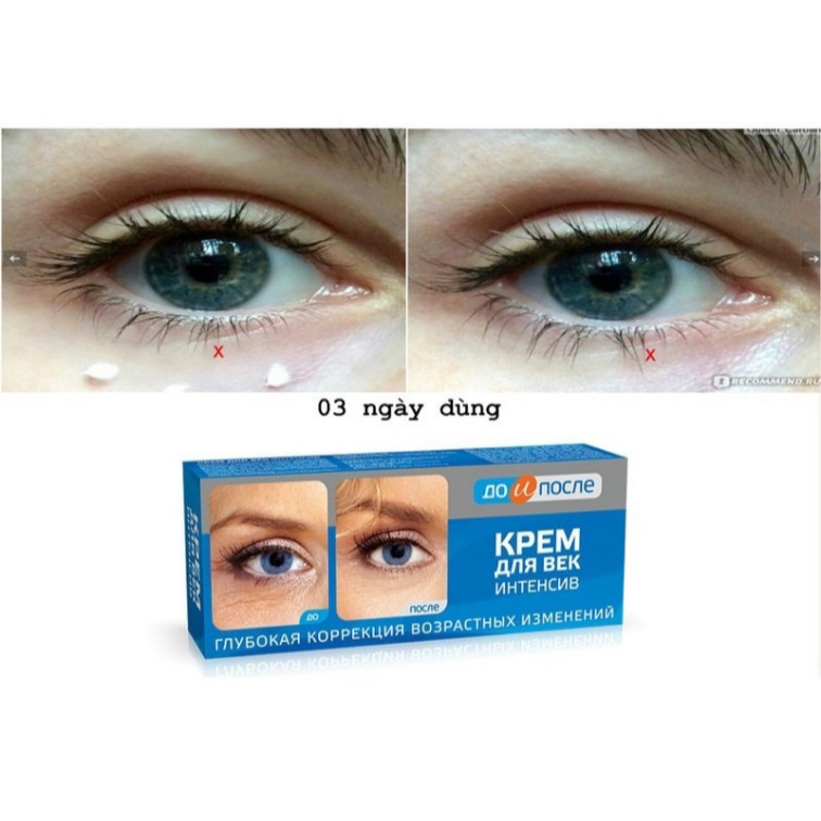 Kem chống nhăn mắt Kpem kem dưỡng mắt giảm quầng thâm hết nhăn mắt sụp mí [𝐓𝐚̣̆𝐧𝐠 𝐦𝐚́𝐲 𝐦𝐚𝐬𝐬𝐚𝐠𝐞 𝐦𝐚̣̆𝐭]