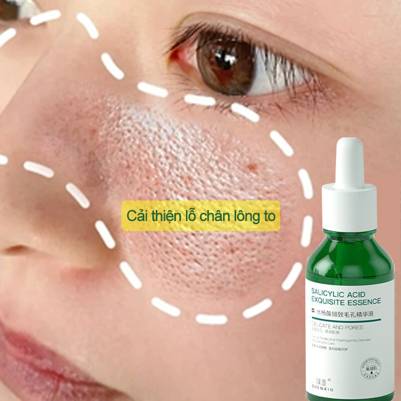 Serum trắng da serum se khít lỗ chân lông30ml se khít lỗ chân lông trị mụn đầu đen vết mụn dưỡng ẩm