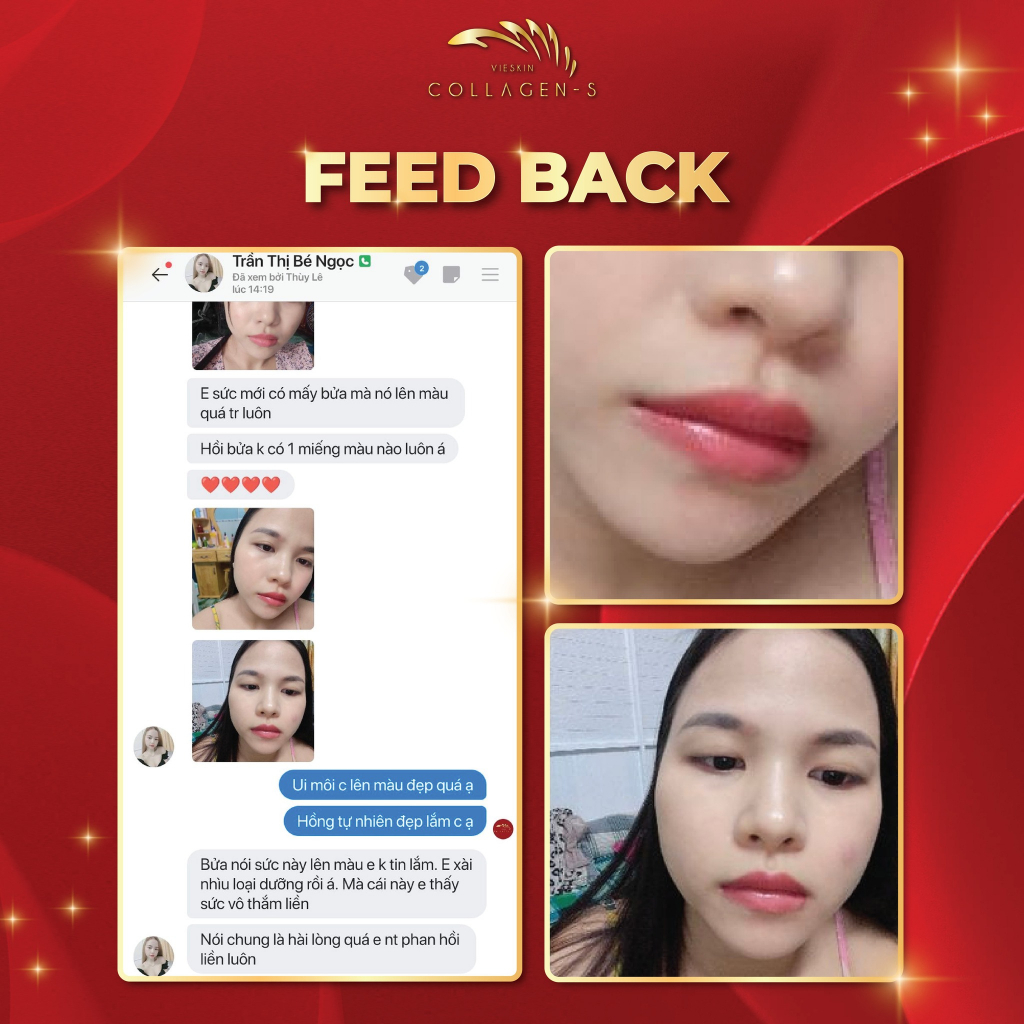 Tinh chất dưỡng kích màu môi sau phun xăm Vieskin GoldShine, collagen tươi kích màu sắc nét, tự nhiên, căng bóng, 7ml