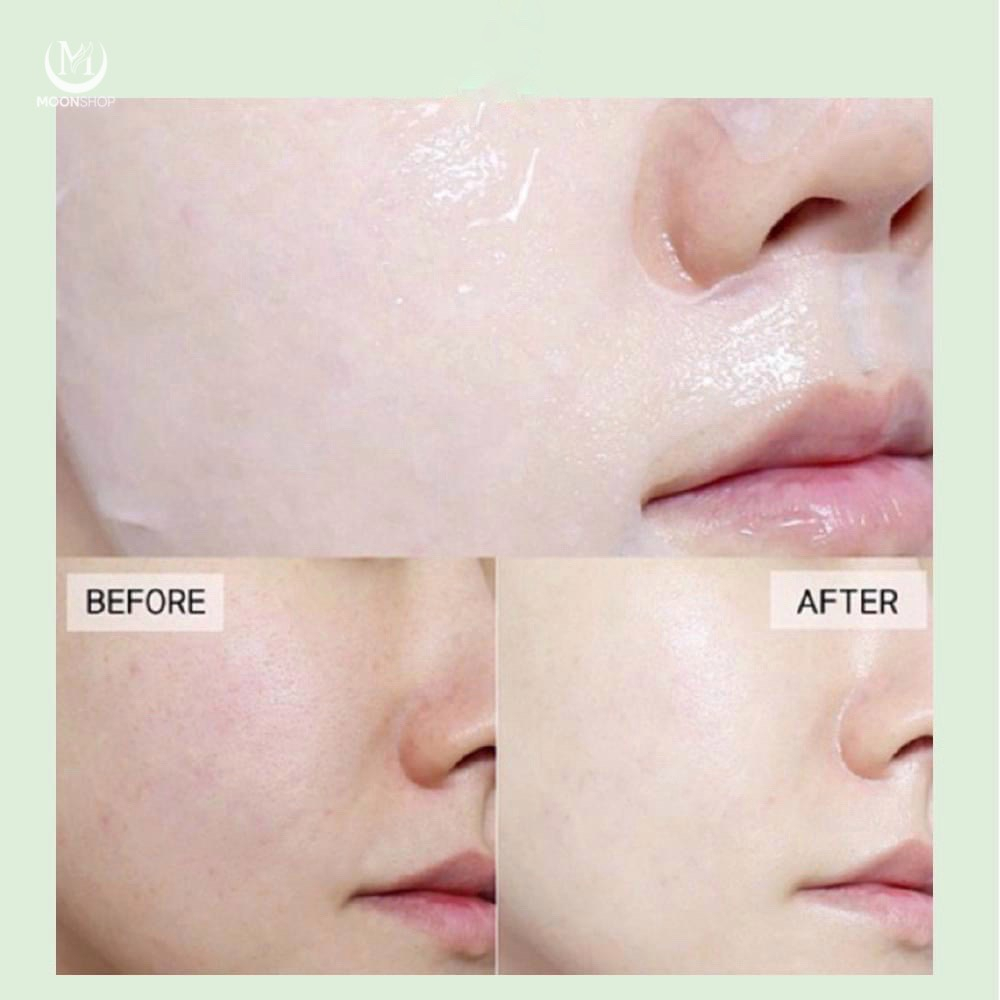 Nạ Giấy Mediheal Watermide Hydrop Rex