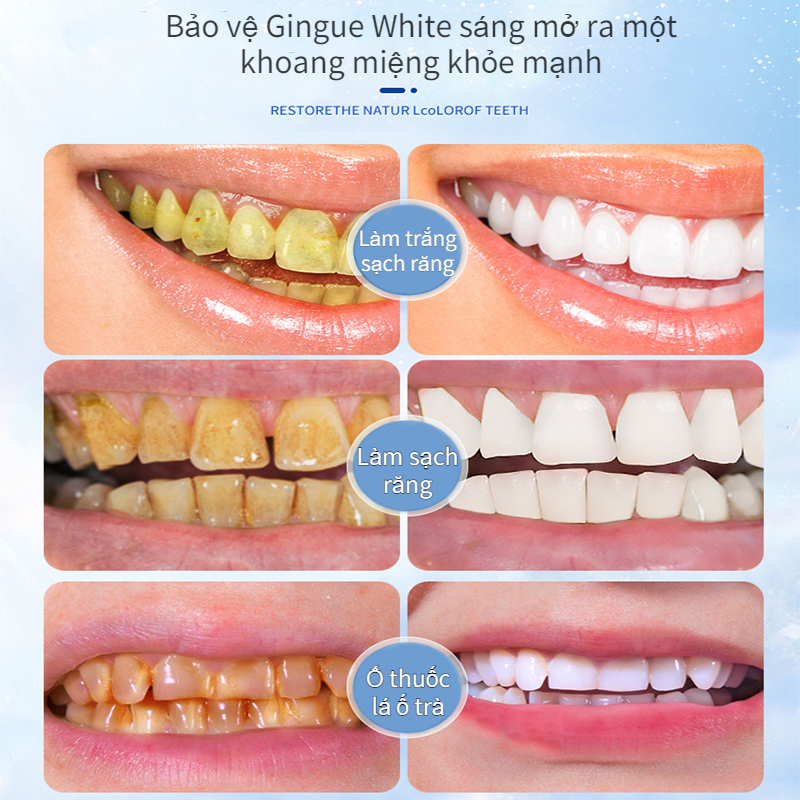 Kem đánh răng Làm trắng răng 100g Giảm sâu răng Làm sạch mảng bám Loại bỏ kem đánh răng làm trắng vàng