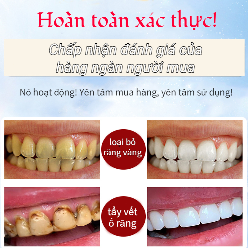 Kem đánh răng Làm trắng răng 100g Giảm sâu răng Làm sạch mảng bám Loại bỏ kem đánh răng làm trắng vàng