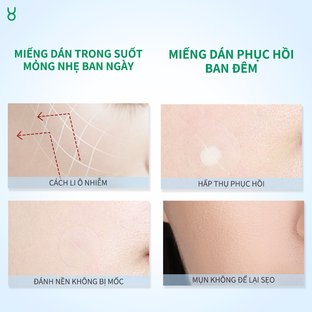 Miếng Dán Mụn BHA FOCALSKIN Siêu Mỏng 0.01cm Hút Mụn Sạch + Giảm Sưng + Che Mụn Makeup 60M Ngày Đêm | BigBuy360 - bigbuy360.vn