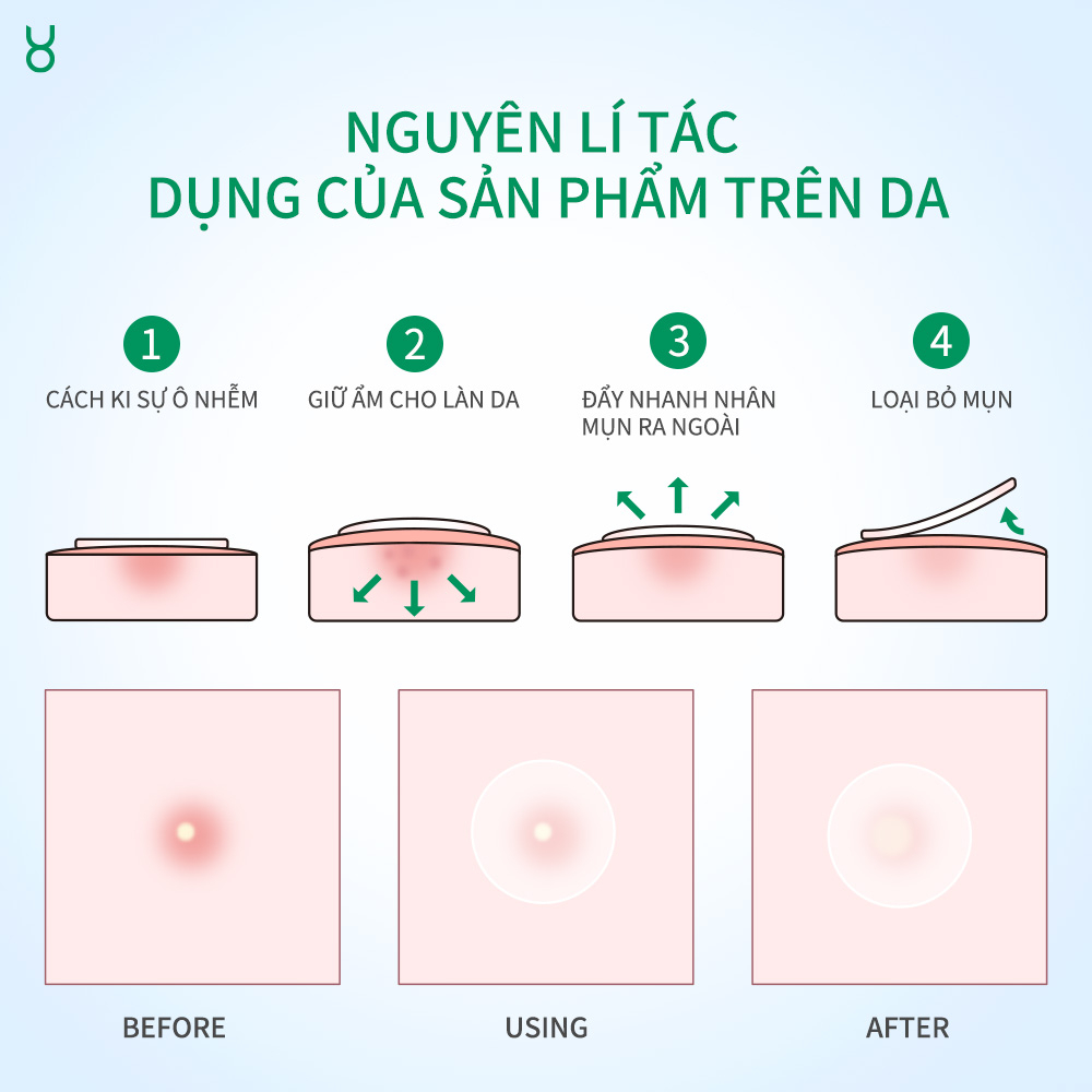 Miếng Dán Mụn BHA FOCALSKIN Siêu Mỏng 0.01cm Hút Mụn Sạch + Giảm Sưng + Che Mụn Makeup 60M Ngày Đêm | BigBuy360 - bigbuy360.vn