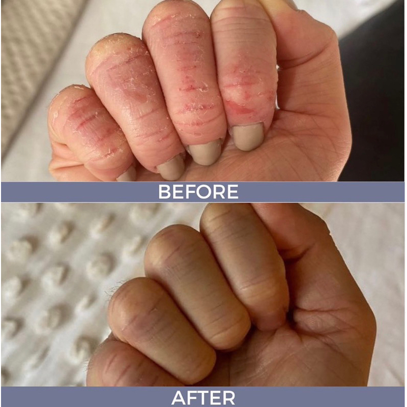 LANOLIPS Kem dưỡng da tay Rose Hand Cream Intense chứa lanolin cho da tay khô nhạy cảm