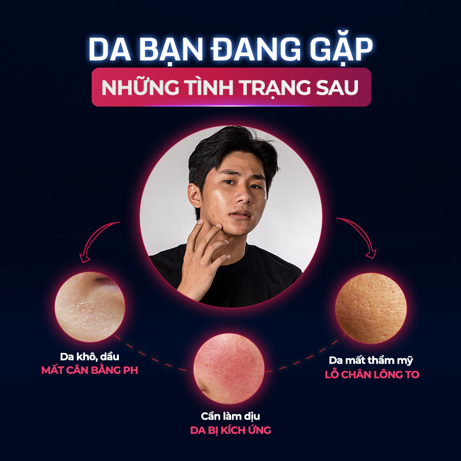 Nước Cân Bằng Giúp Cân Bằng Độ Ẩm Làn Da Dành Cho Nam Giới The Menco Fresh CentaToner 100ml | BigBuy360 - bigbuy360.vn