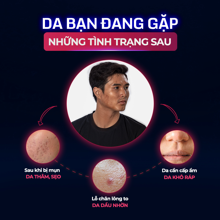 Combo Serum Mờ Thâm Trắng Da Kiềm Dầu Dành Cho Nam Giới Lightening Serum 30ml và Sữa rửa mặt Cool Facial Gel 120ml