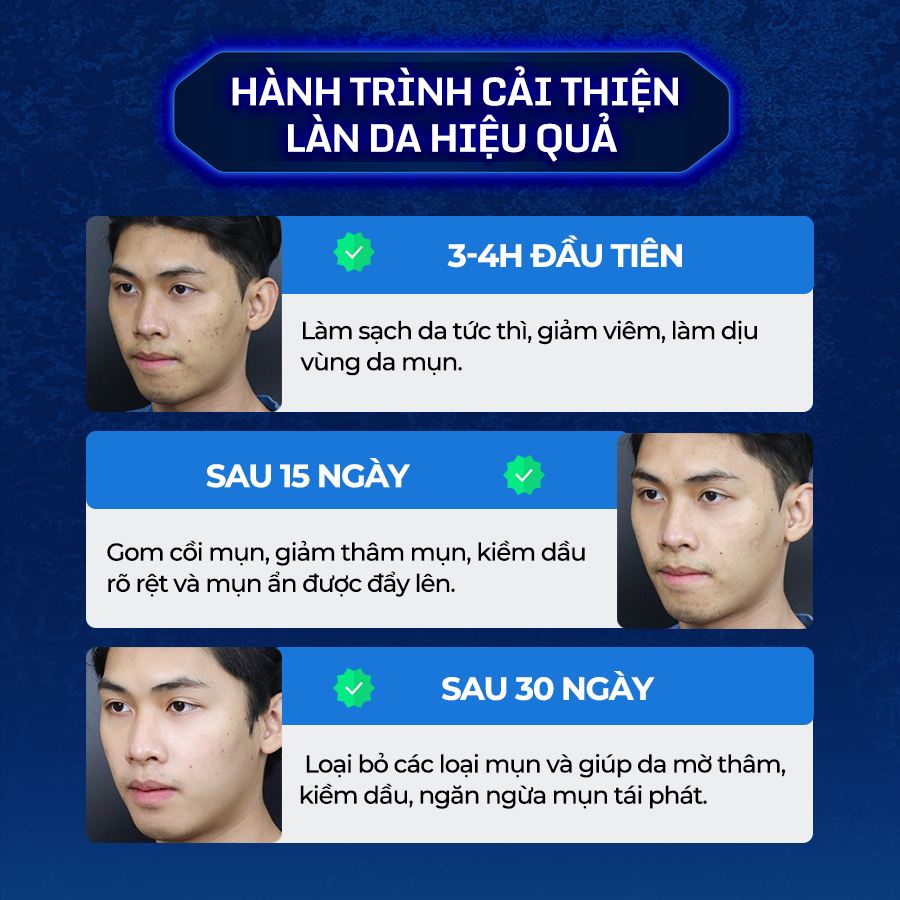 Combo Serum Mờ Thâm Trắng Da Kiềm Dầu Dành Cho Nam Giới Lightening Serum 30ml và Sữa rửa mặt Cool Facial Gel 120ml