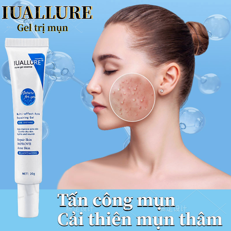 Gel Giảm Mụn Kem dưỡng giảm mụn Gel ngừa sẹo Mụn 20g giảm mụn trứng cá thu nhỏ lỗ chân lông làm trắng dưỡng ẩm