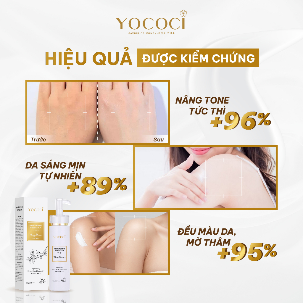 Kem Dưỡng Trắng Da Body YOCOCI Dưỡng Ẩm, Chống Nắng, Nâng Tone White Perfect Body Lotion 150g