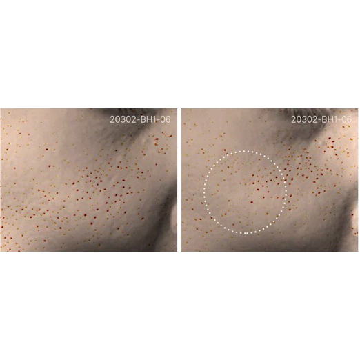 Thiết bị tăng sinh collagen AGE-R USSERA DEEP SHOT Medicube - BH 1 đổi 1