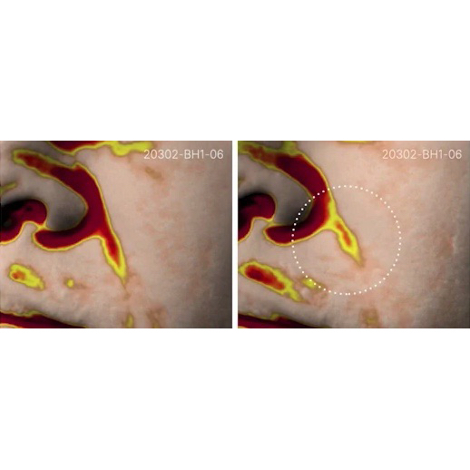 Thiết bị tăng sinh collagen AGE-R USSERA DEEP SHOT Medicube - BH 1 đổi 1