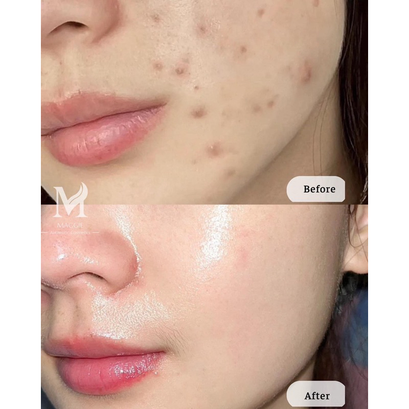 SERUM NACOMI NIACINAMIDE 20% 30ML