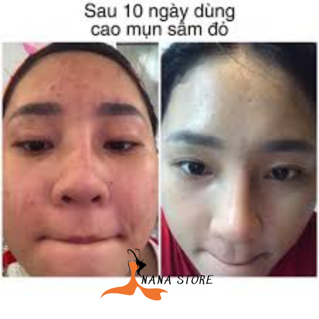 Combo Cao Sâm Đỏ Và Cốt Thảo Dược Meea