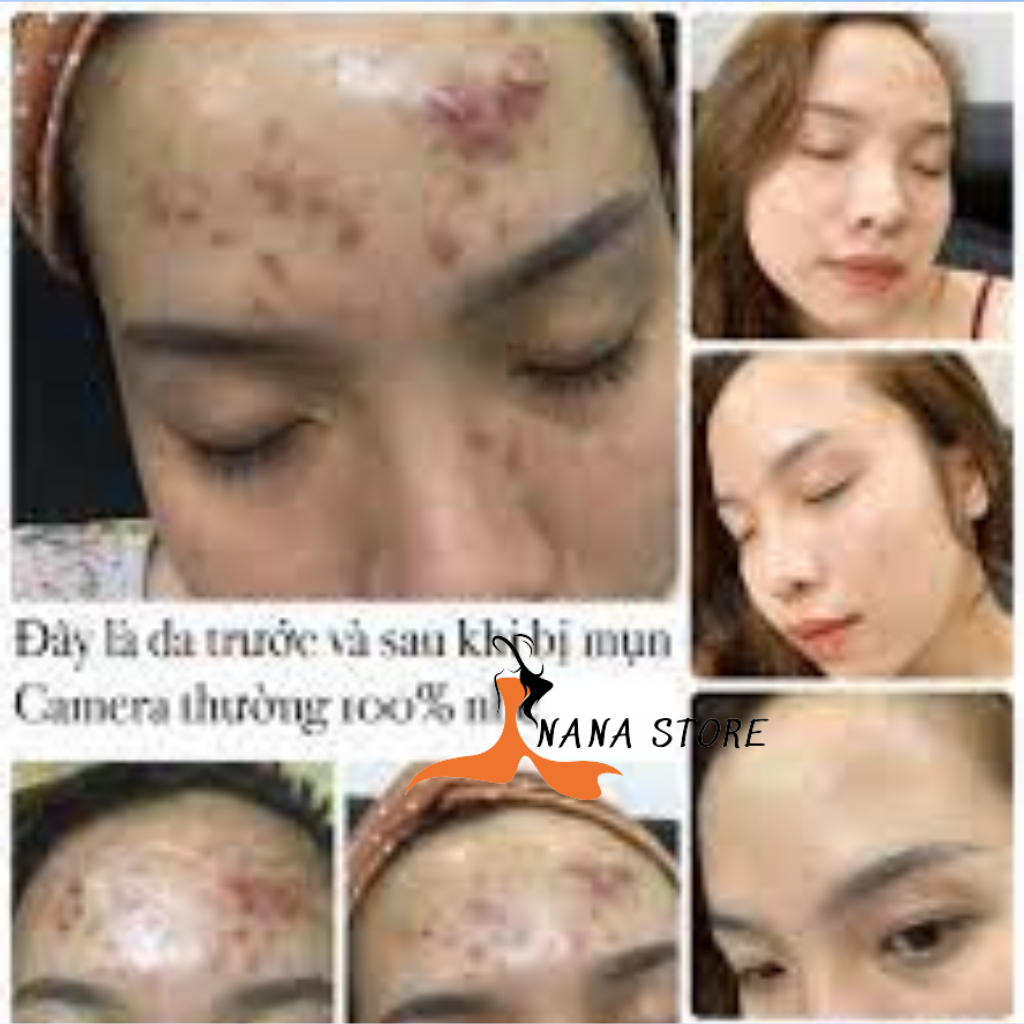 Combo Cao Sâm Đỏ Và Cốt Thảo Dược Meea