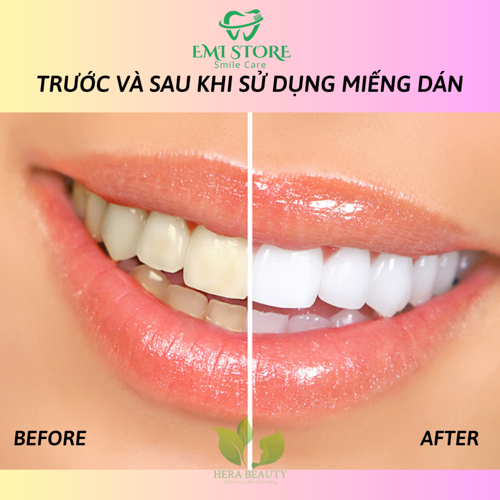 [SET 7 GÓI] Miếng dán trắng răng Crest 3D White  - Răng trắng sáng, an toàn cho men răng | BigBuy360 - bigbuy360.vn