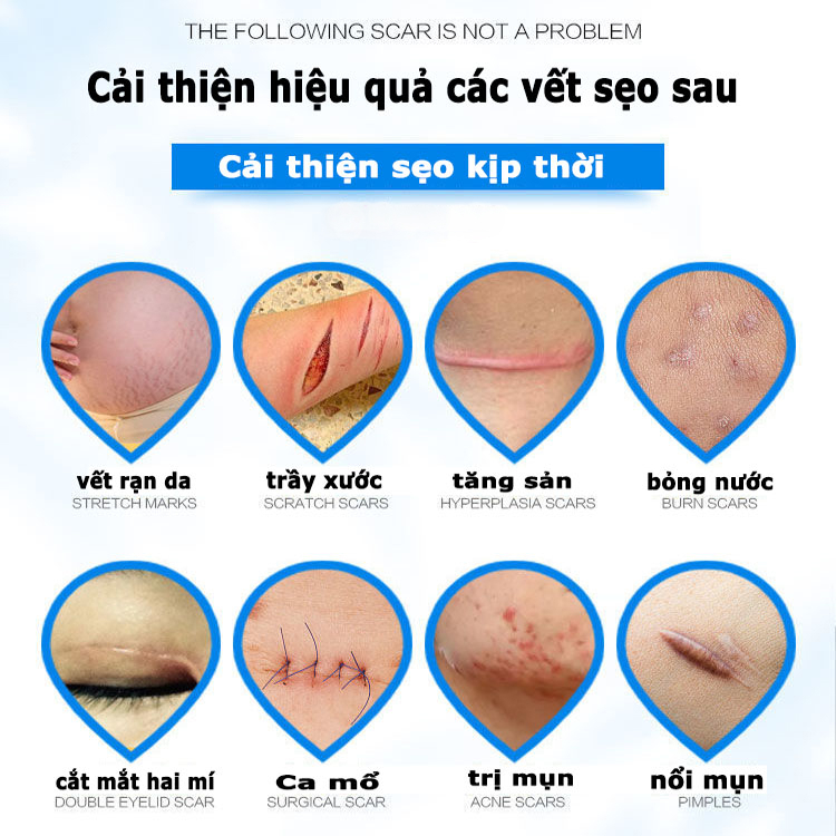 Hiệu quả nhanh chóng kem trị sẹo thâm/trị rạn da sau sinh/sẹo rỗ/trị sẹo lồi thuốc trị sẹo bỏng