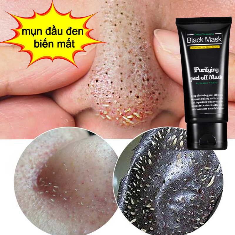 Trị mụn đầu đen mặt nạ than tre mặt nạ trị mụn 60ml Lột Mụn Đầu Đen Làm Sạch Sâu Se Khít Lỗ Chân Lông
