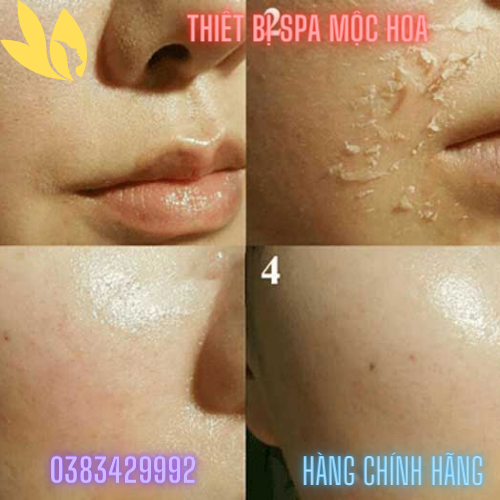 Vi Kim Thảo Dược, Siêu Vi Kim Thảo Dược, Vi Sinh Thảo Mộc Chính Hãng lọ 50g làm được 15 mặt