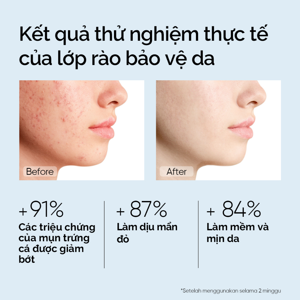 Combo dưỡng ẩm sáng da SKINTIFIC gồm Gel dưỡng ẩm MSH 5% Niacinamide 30g + Gel dưỡng ẩm 5X Ceramide 30g