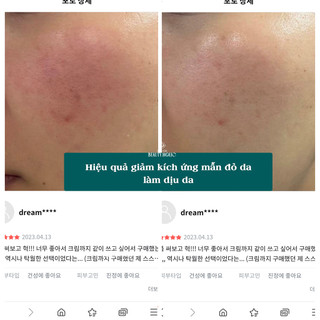 [SALE LỖ DỌN KHO DATE T2-T4/2026] Bộ dưỡng cam thảo I'M FROM LICORICE