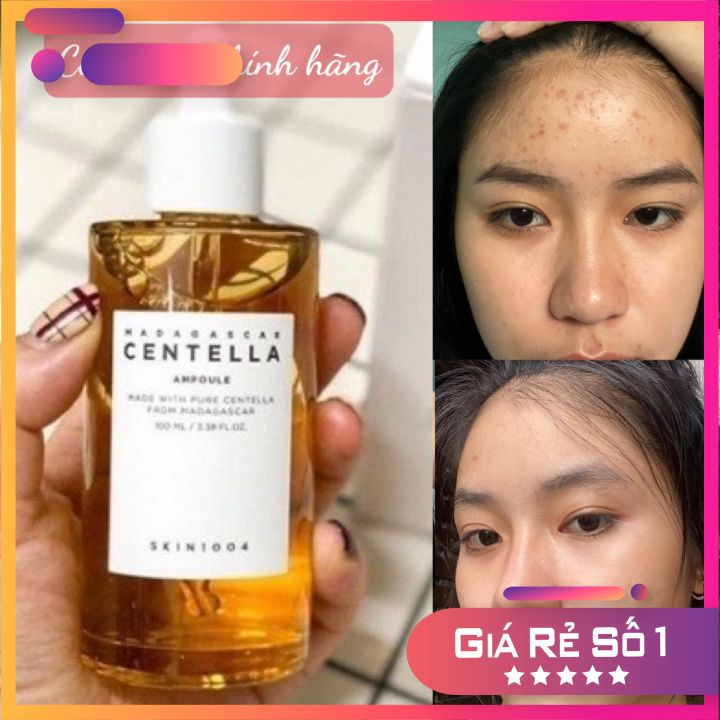 😱😱Tinh Chất Rau Má giảm mụn, mụn đầu đen Skin Centela Serum 100ml