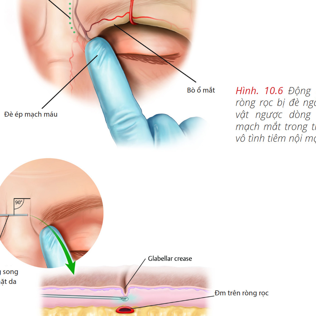 Y HỌC. Những vùng nguy hiểm trên khuôn mặt. .Thư Viện Y Khoa.