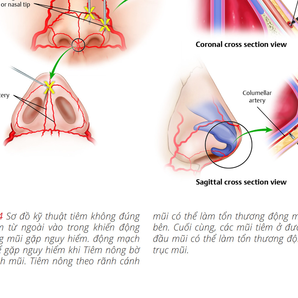 Y HỌC. Những vùng nguy hiểm trên khuôn mặt. .Thư Viện Y Khoa.
