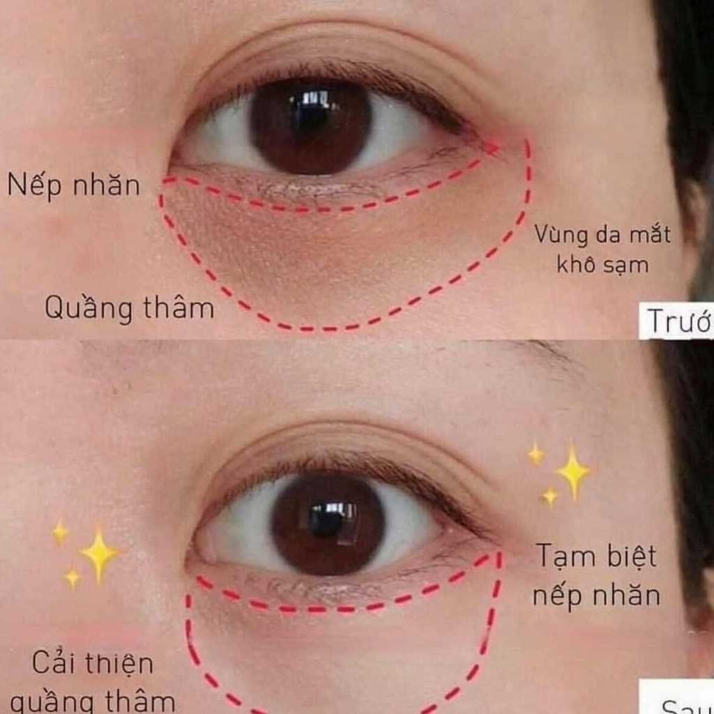 M82_Kem Dưỡng Da Vùng Mắt Haruharu Wonder Black Rice Bakuchiol Eye Cream 20ml