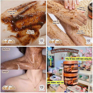Tẩy da chết quế hồi Nga