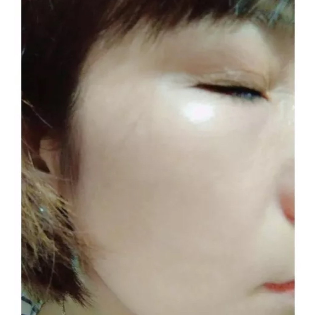 Vua nám skin baby 3 loai 1 MH spa