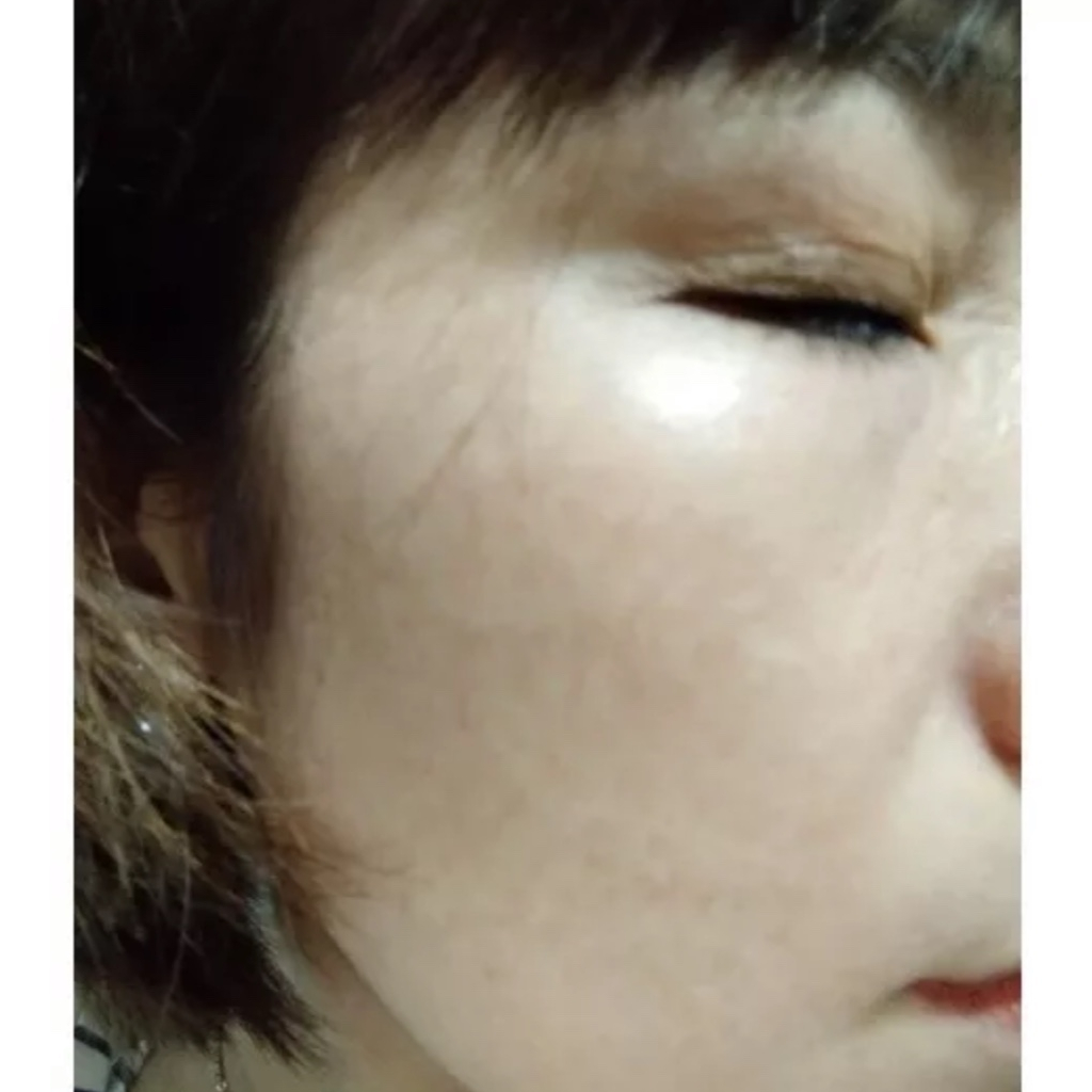 Vua nám skin baby 3 loai 1 MH spa