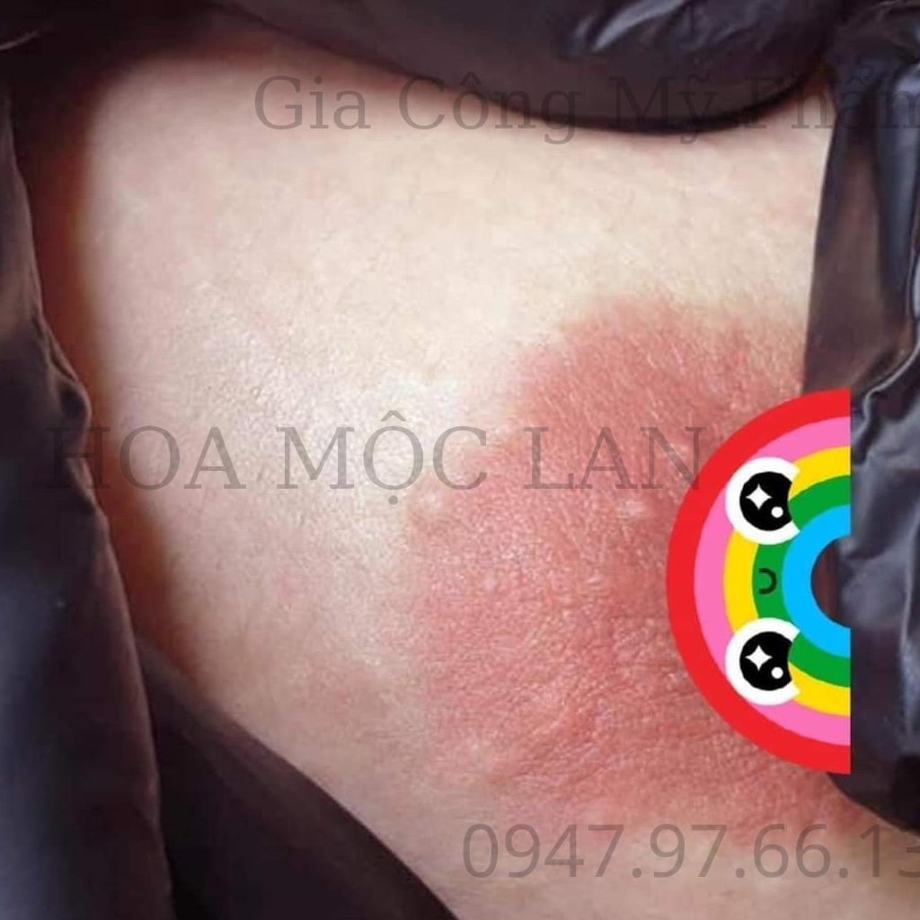 Combo Peel + Làm Hồng Nhũ Hoa - Bikini Hiệu quả 2 trong 1 Nipple Pink