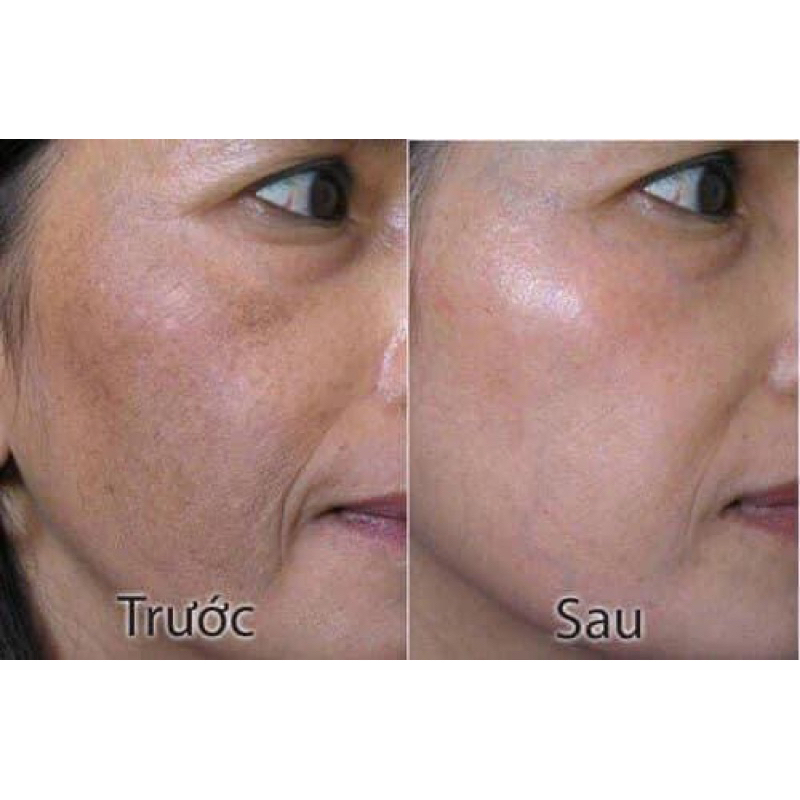 KEM NỌC RẮN HONGIKSKIN STEM 107