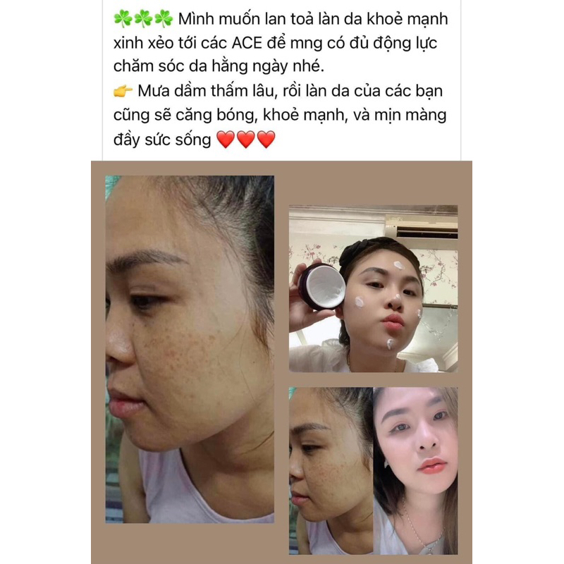KEM NỌC RẮN HONGIKSKIN STEM 107