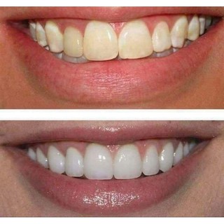 Bột trắng răng PW WHITENOW