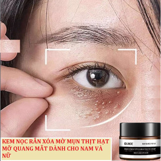 Kem xóa mụn thịt hạt mỡ quang mắt và mờ vết quầng thâm mắt