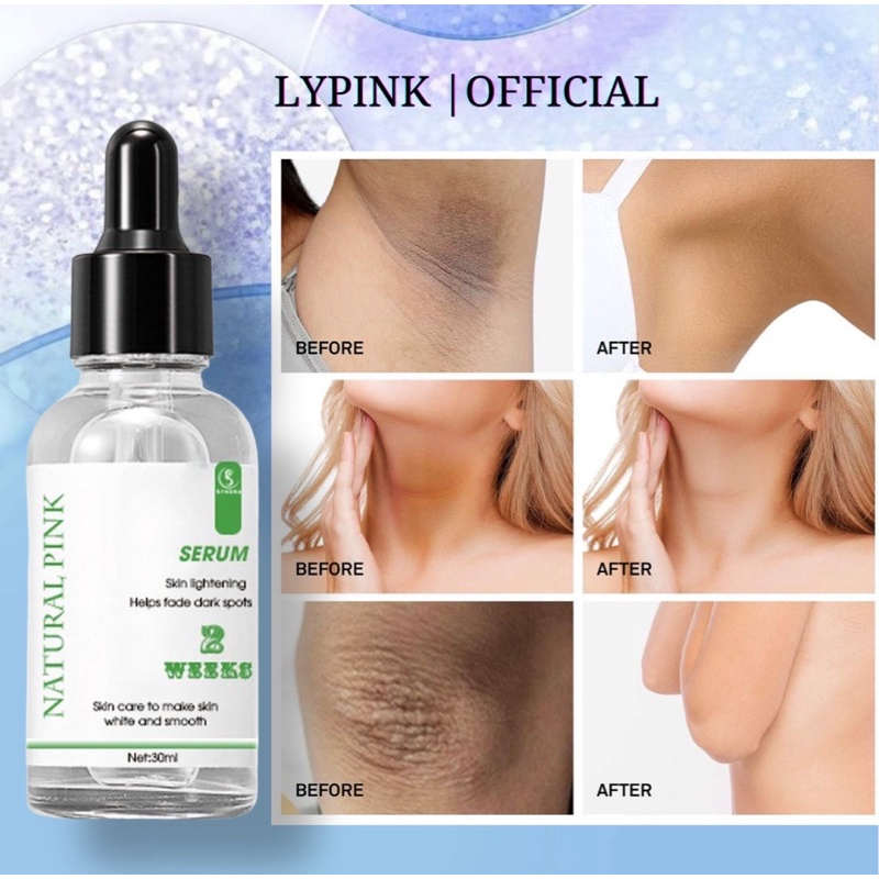 Serum Natural Pink mờ thâm cơ thể nách, đầu gối hiệu quả, nhanh chóng