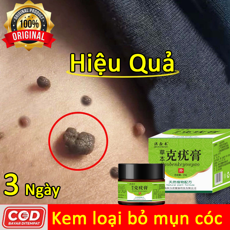 COD Kem loại bỏ mụn cóc an toàn xóa nốt ruồi mụn cóc sạch mụn thịt mụn nốt duồi và các mụn li ti quanh mắt thừa mụn thịt