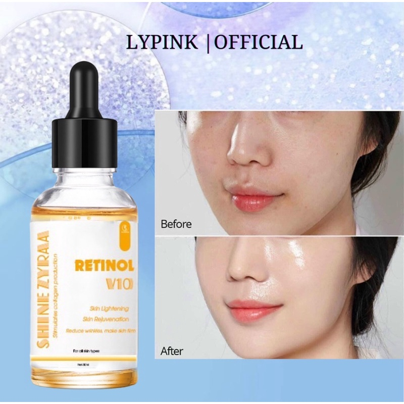 Serum Retinol V10 căng bóng da, ngăn ngừa lão hoá, giảm nếp nhăn