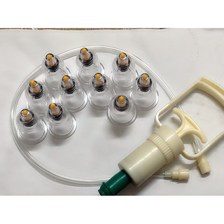 Bộ ống hút máu bầm