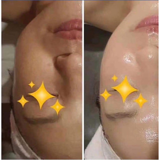 Serum Herba căng bóng