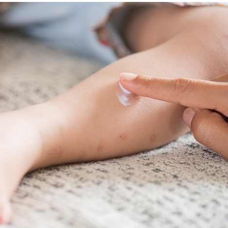 Kem Mopiko Bôi Ngoài Da Ngăn Muỗi Đốt, Côn Trùng Cắn, Giảm Ngứa, Ngừa Sẹo 20g