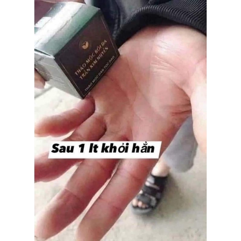 KEM BÔI DA TRẦN KIM HUYỀN CHỐNG NẤM VIÊM