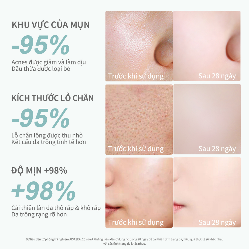 AiSASEA nước tẩy trang Centella dưỡng ẩm khuôn mặt môi mắt Da nhạy cảm Làm sạch sâu